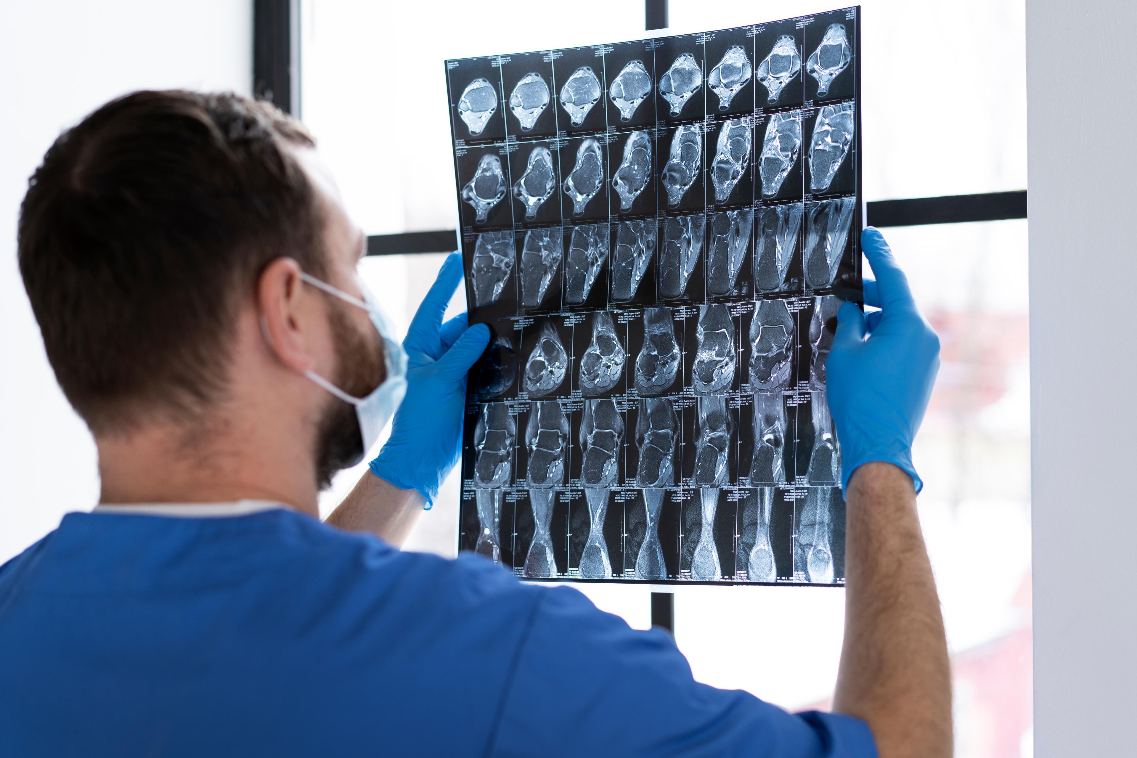 mri